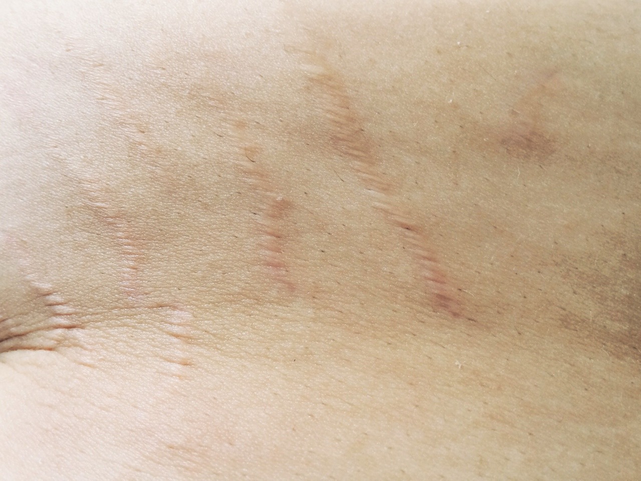 virginsplayground:  These are the parts of myself that I have been taught not to