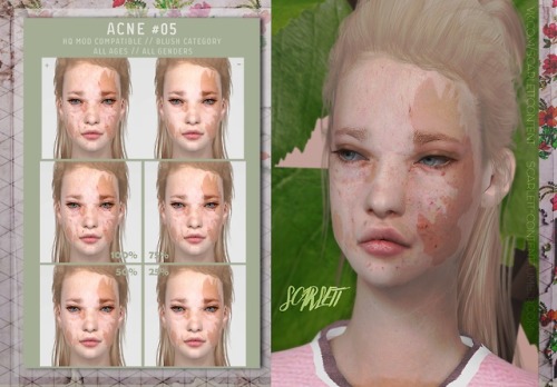 ACNE #05◊ DL // HQ PIC // ☕ ◊- Don’t re-upload;- Don’t use my textures without permission;- Feel fre