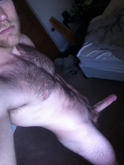 A super hairy body