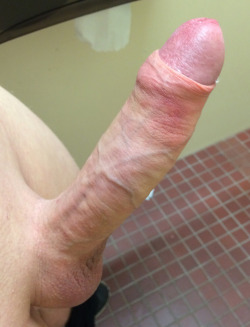 yesforeskin: Peeling