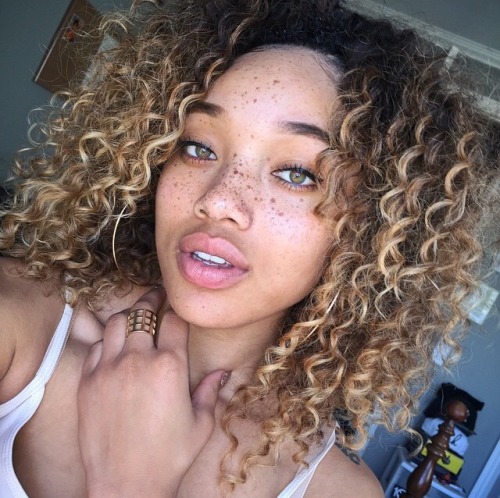 deerspace: forjeditorap: Glorious Melanin Your freckles give me goosebumps,you’re gorgeous