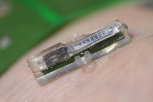 8bitfuture: Tiny implant can transmit realtime blood data to your doctor. Researchers at Switzerland
