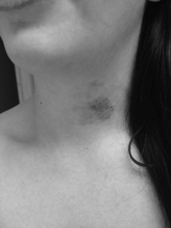 Crazykissing:  Letmecatchmybreath:  I Love Hickies, I Love Having A Physical Reminder