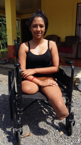 Quad amputee