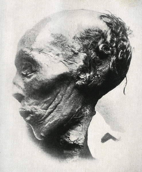 Mummy of Thutmose IIHead of the mummy of Thutmose II (r. ca. 1493-1479 BC). The fourth Pharaoh of th