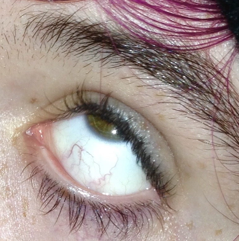 emseear:  Woah weird huh