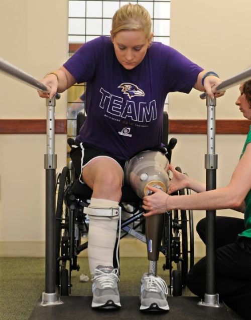 Boston Marathon bombing victim gets new leg