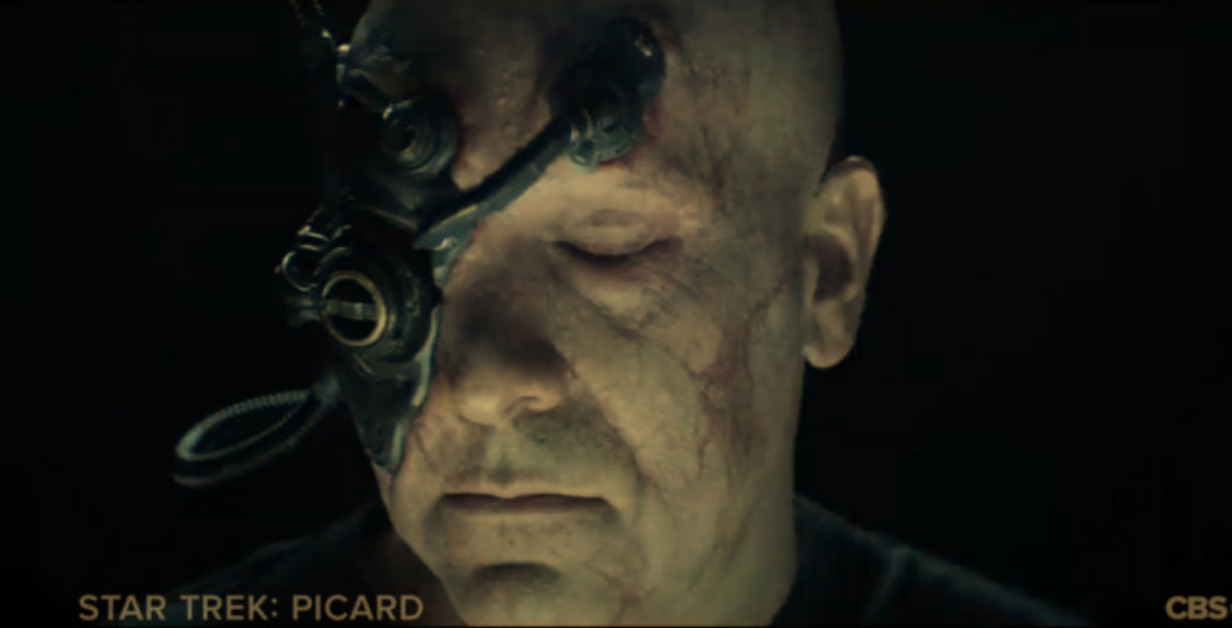 A new Borg drone, with the right side of his face obscured by implants, including his right eye
