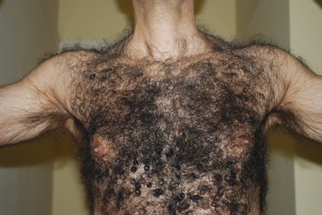 hirsuteluvr:  Heavenly   OMG - exceptionally hairy - I love it - WOOF  Wished he was all mine!