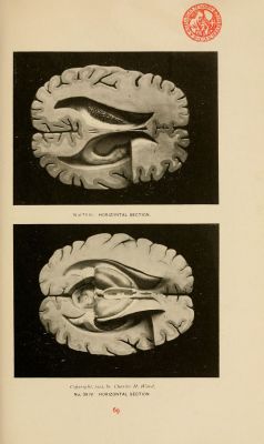 nemfrog:  Models of the brain. Catalogue of human and comparative skeletons, osteological specialties, and anatomical models. 1902. 