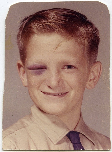 imperialgoogie:  memories65:  Class photo with a black eye, 1961  Yeah, but you should see the other guy. 