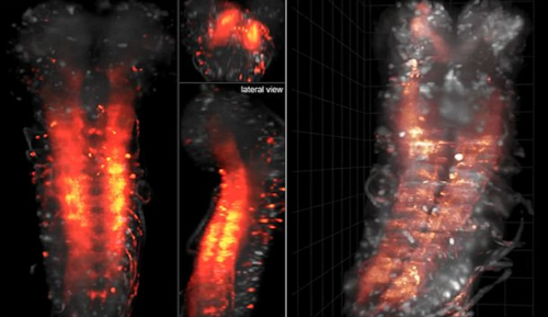 neurallace:    Central nervous system activity filmed for the first time 