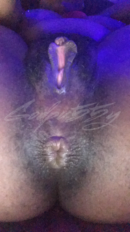 godpu55y:  The after effects of pumping my hairy asshole