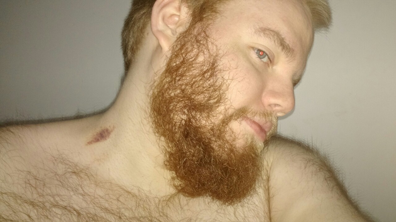 arcticferedir:  Sometimes hickies can just be a sign of a good night. Didn’t know