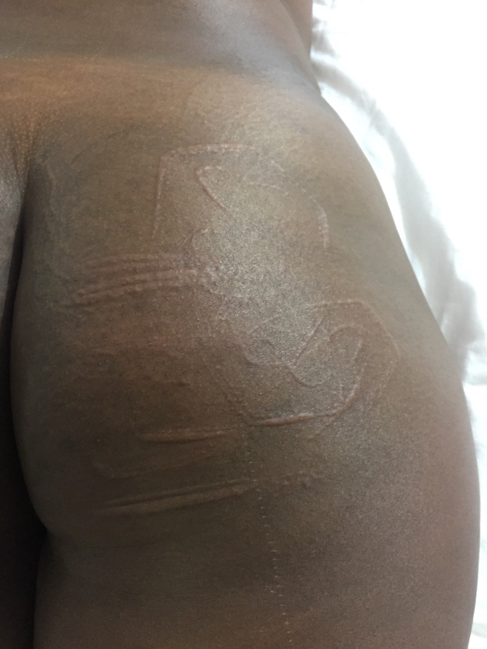 prettyperversion: Beautifully Beaten and bruised  @prettyperversion Photographer