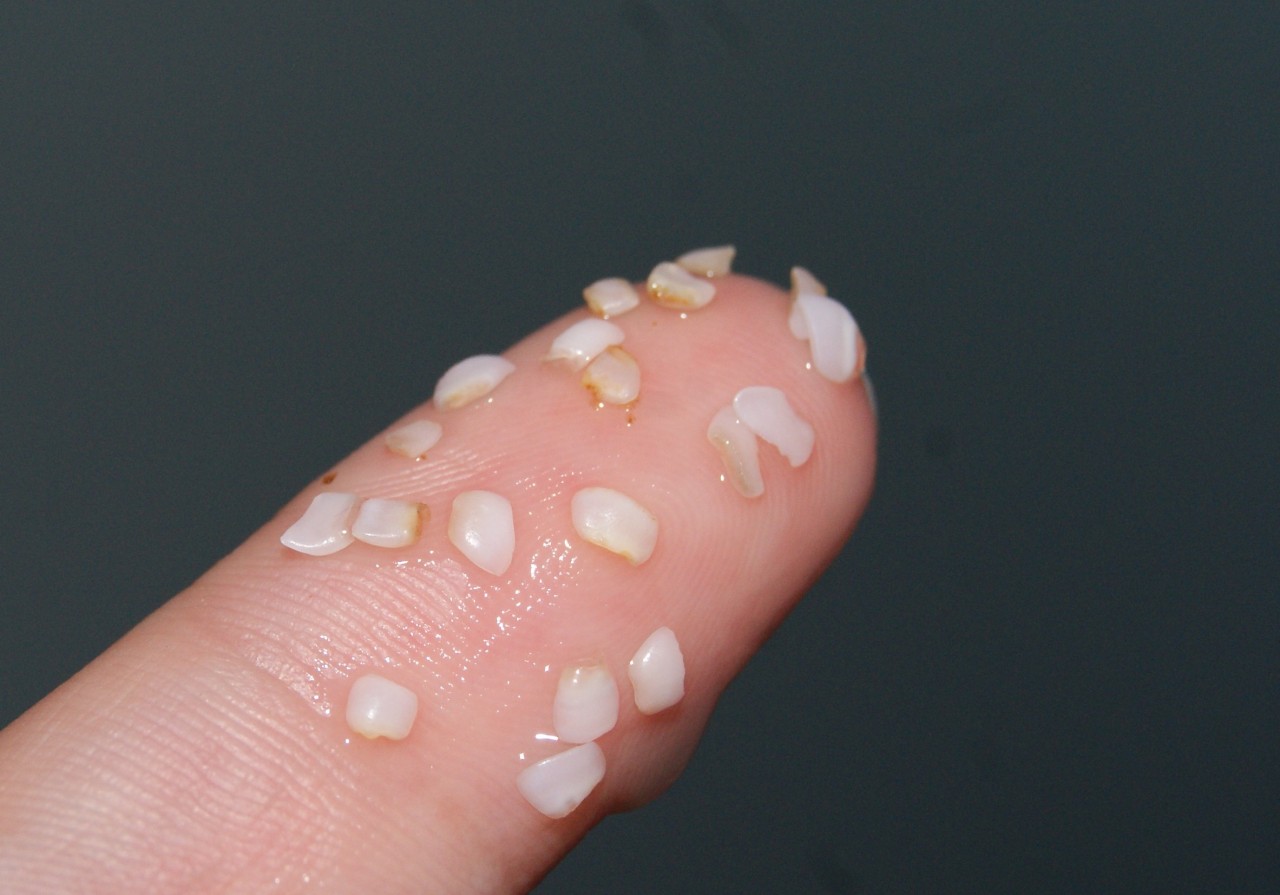 forgetthebowl:  What are these things? Why they’re goldfish teeth! Goldfish don’t