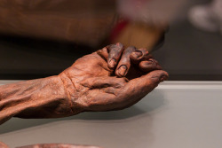 Brilliantinemortality:  The Hand Of Oldcroghan Man (D. 362-175 Bc), Preserved In