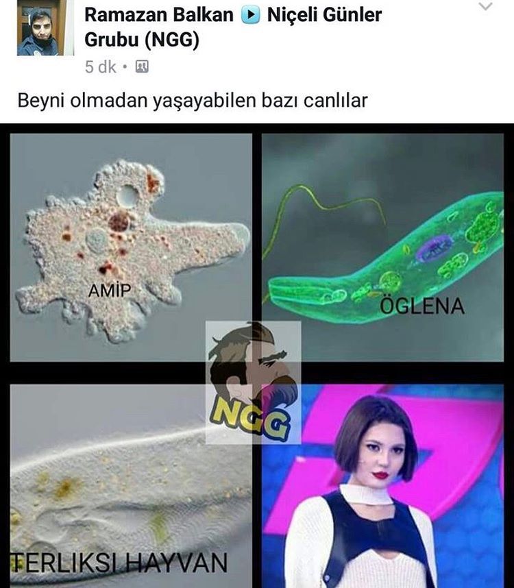 Beyni olmadan yaşayabilen...