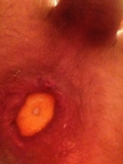 Machineanddildofucked:  My Ass Swallowed An Orange  A Very Good Cunt Stretchingfollow