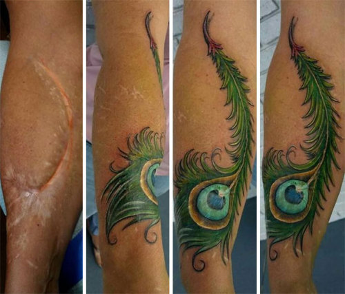 308rider:kickdrumheart68:auto-filling-daydreams:pr1nceshawn:Tattoos That Turned People’s Scars Into 
