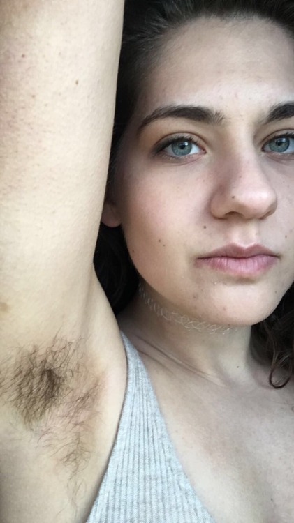 tongue-tied-lightning: Normalize body hair ! I stopped shaving my armpits bc it irritated my skin an