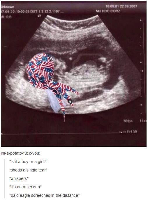 itsstuckyinmyhead:  American photoset #23 more? Australian Photoset #22