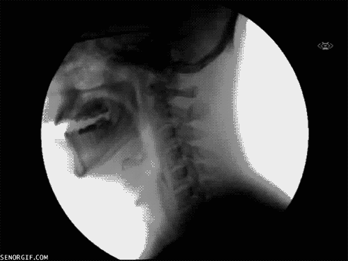 sixpenceee: X-ray of fluid going down the esophagus.