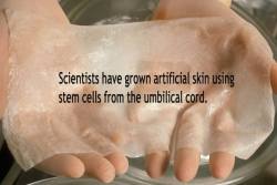 scienceyoucanlove:  Researchers made a new type of artificial skin using stem cells from the umbilical cord, fibrin and agarose. This is great news because this type of skin can be stored in tissue banks and can be applied instantly, speeding the recovery