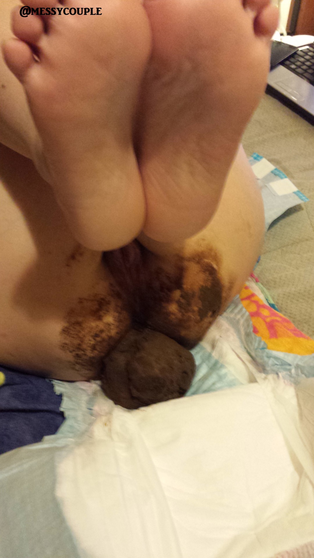 messycoupleonfetlife:  Poopy nappy change. Actually not really a change, just a transfer