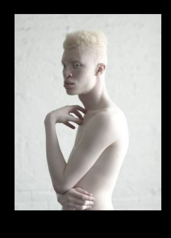alanspazzaliartist:  Albinos looks so misterious…1.Bera Ivanishvili2. Steven Thompson3.Sanele