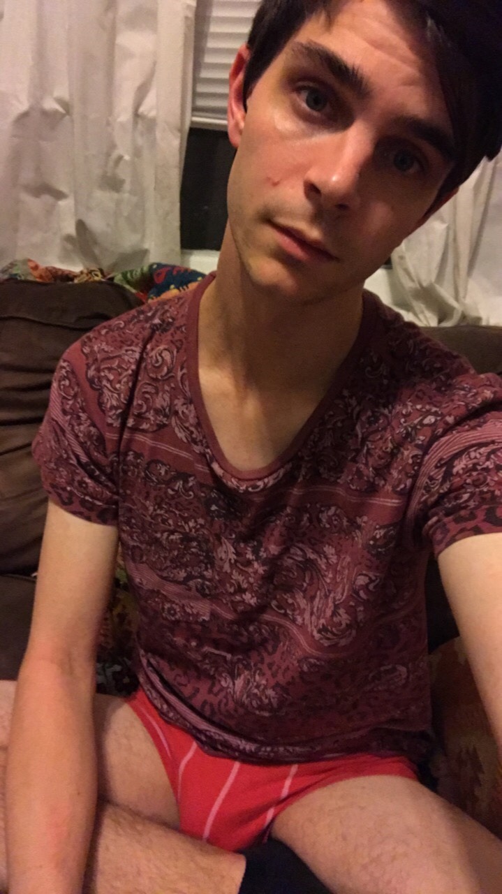 alifeinhyperbole:  Been a long day Feat. My enormous pimple