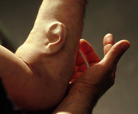 sixpenceee:  Artist Gets an Extra Ear Implanted Into His ArmAustralian performance