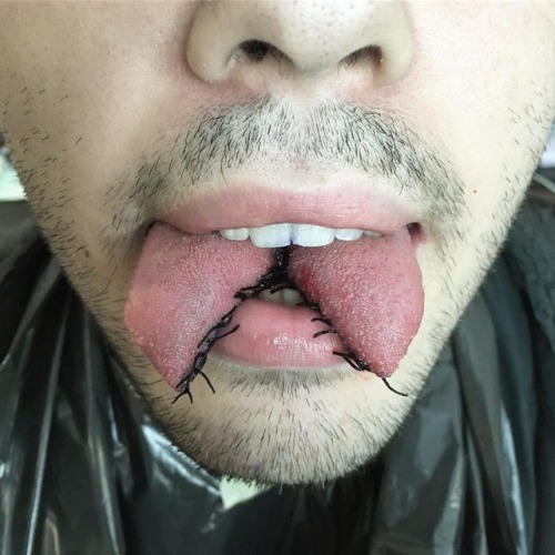 yann-brenyak:#tonguesplit #tongue #deepsplit #deep #bodmod #bodymods #bodymodification #nomad #yannb