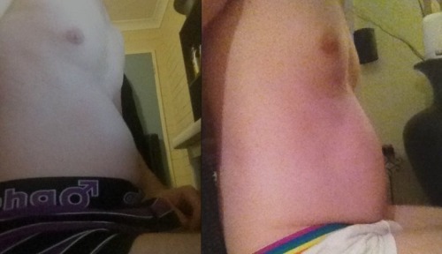never-fat-enough:  stannumgains:  Left: My first comparison picture from only two months ago. Right: Tonight almost a year into gaining and nearly 50lbs up. Here’s to another 50 :)  No matter what I tell him, he doesn’t believe me that he’s gotten