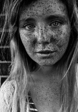 I Love Lots of FRECKLES!