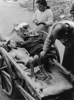 collectivehistory:  Emergency workers treat a young victim of the atomic explosion. He was brought to the temporary aid hospital on a cart, but died soon afterwards. (Magnum Photos) 