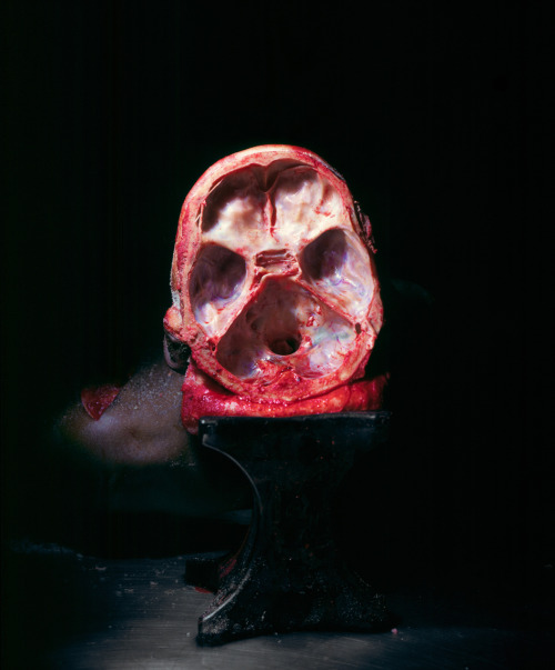 ether927:  Incredible photos from the operating room taken by Max Aguilera-Hellweg in his book The Sacred Heart, An Atlas Of The Body Seen Through Invasive Surgery, 1997, Bulfinch Press, Little Brown & Company, New York   https://www.behance.net/galle