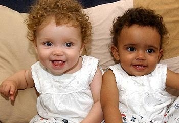 xavierbs: Black and white twins I didn’t realize this was possible.YEAH! GENETICS, BITCH!