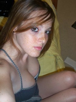 silentorgasm:  Outstanding freckles.  I