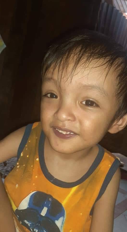 Please If You Can Share And Spread This,pls Do..a Baby Needs An Assistance For His Life