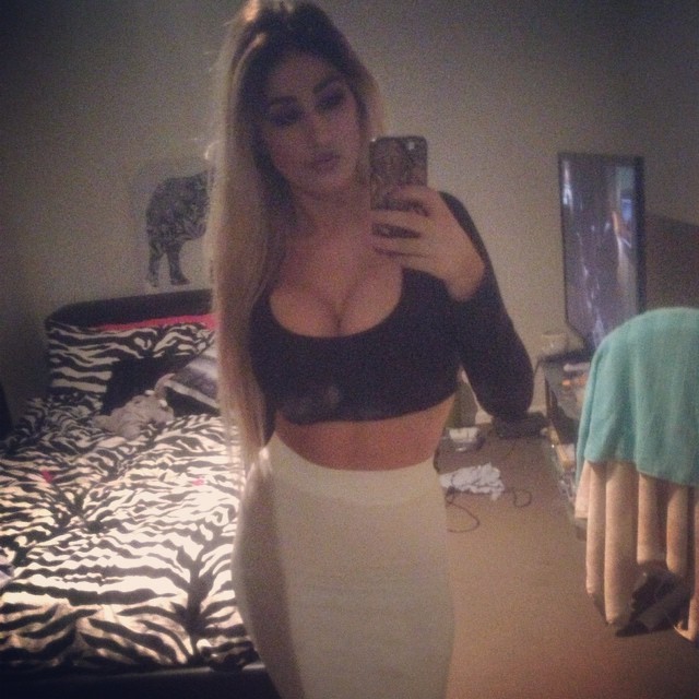 amateur-implant-pics:  d__p__johnston