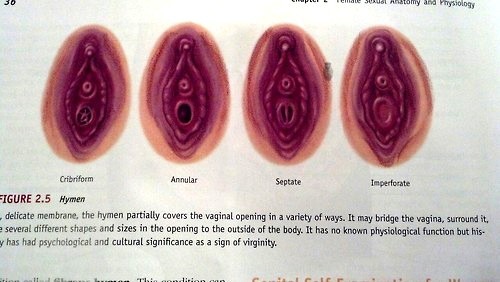 sexualitics: Take a look at these beautiful hymens! It’s a common misconception that all women are b