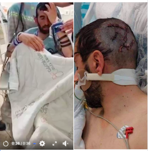 Baruch Hashem!!This is Shai Ben Shlomo who was brutally attacked by 2 terrorists who hacked 3 Jews t