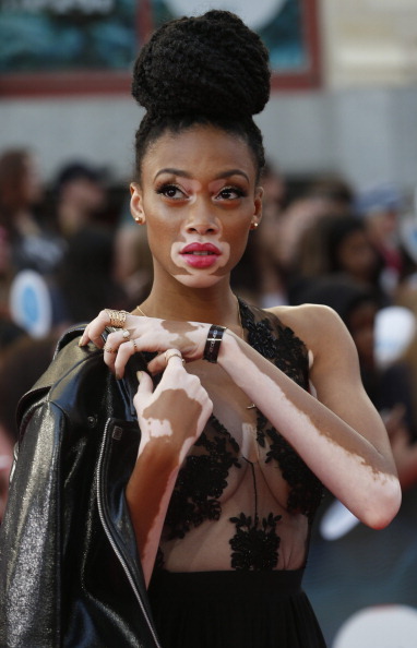 vsvptayty:  Winnie Harlow at the 2014 MuchMusic Video Awards  