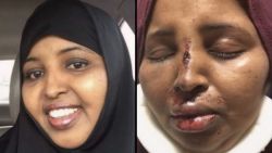 the-movemnt:  Somali single mother in Ohio severely beaten by white man in alleged hate crime The Council of American Islamic Relations’ Columbus, Ohio, chapter is calling on law enforcement to investigate the severe beating of a Muslim Somali woman