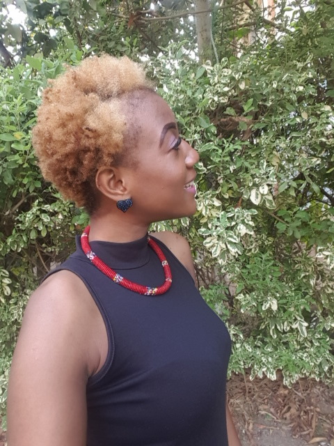 ilovemy4c-hair: Trying to get my edges back. Surgery transplant for that section only cost 3,000
