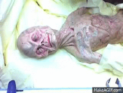 cloakndaggertv:a video from youtube that is showing a supposed being dissected, what do you think??? 