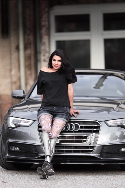 amputeewomen: amputee queen Huelya