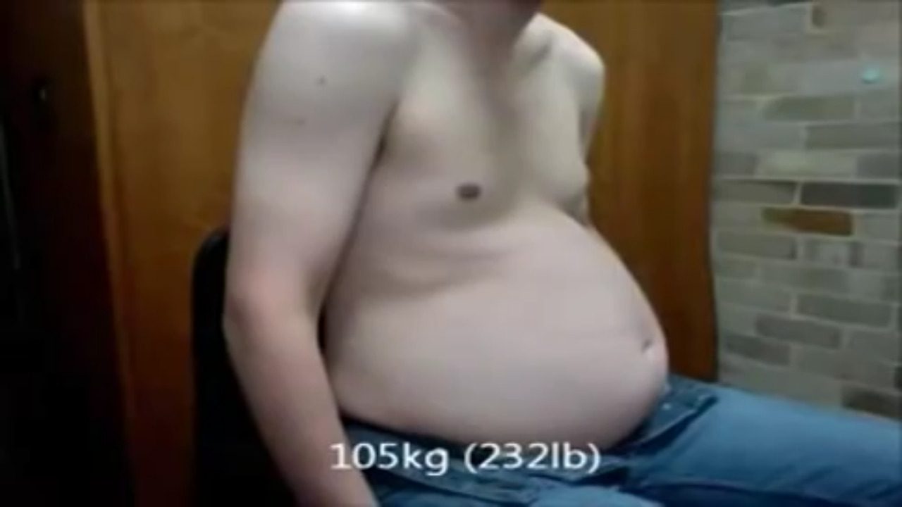 blogartus: admirer88888:  Dude apparently gained 110 pounds quite rapidly.  https://youtu.be/SgB0AySm-SU