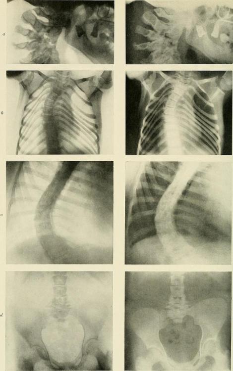 Radiography, x-ray therapeutics and radium therapy, 1915